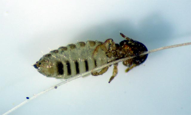 Lice